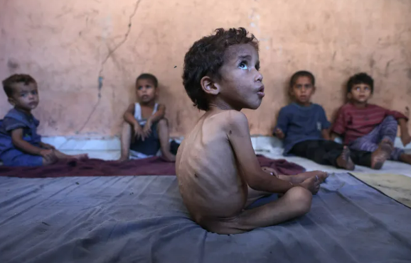 Yazan, um menino palestino desnutrido de dois anos, senta-se com seus irmãos na casa destruída de sua família no campo de refugiados de Shati, a oeste da Cidade de Gaza, em 23 de julho de 2025 [Omar Al-Qattaa/AFP]